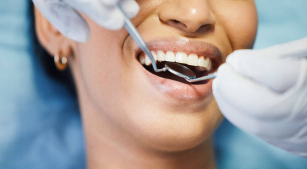 Best Emergency Dentist for Lost Fillings or Crowns in Laurel Hill, VA